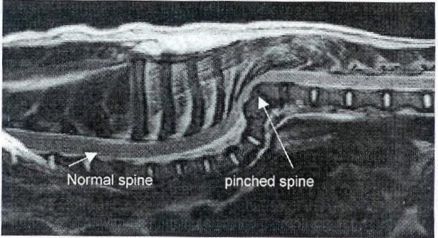 hemivertebrae in pugs